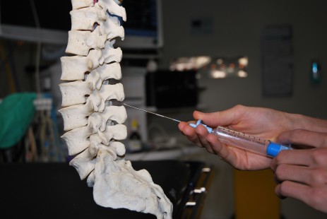 Epidural_needle_insertion_between_the_spinous_processes_of_the_lumbar_vertebrae