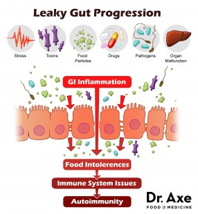 Leaky-Gut-Progression-Dr.-Axe