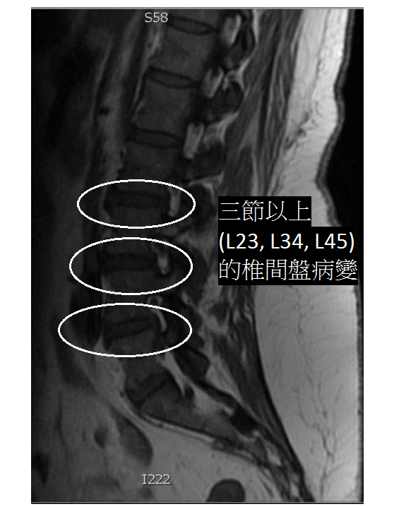 regenerative-medicine-MRI-demonstrating-9-155-g003