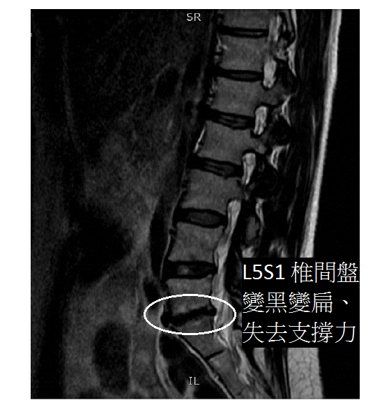 regenerative-medicine-sagittal-lumbar-9-155-g002